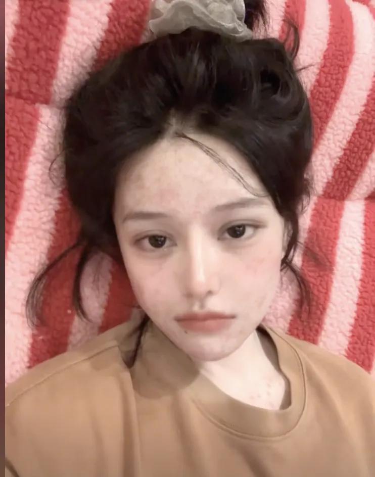 百万粉丝网红放弃直肠癌化疗，后悔仗着年轻忽视了健康